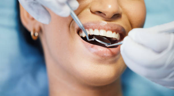 Best Emergency Root Canal Treatment in Luling, TX