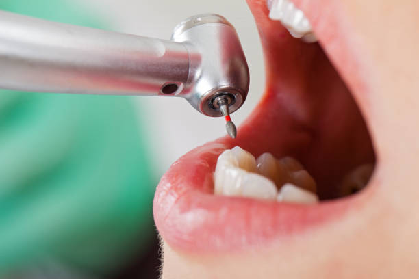 Best Broken or Cracked Tooth Emergency Dentist in Luling, TX